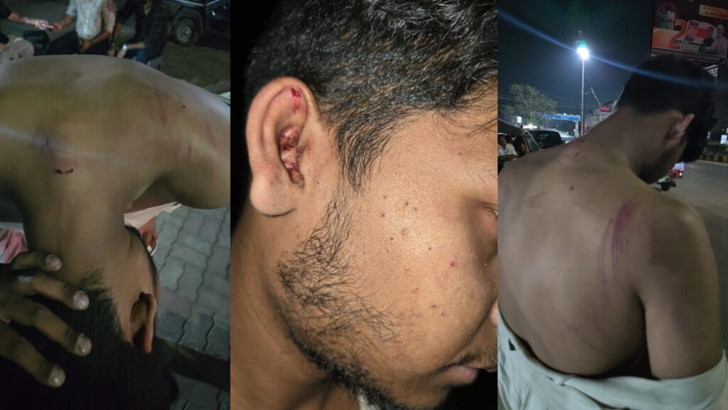रायपुर के NIT के पास नालंदा परिसर में ओडिशा के एक MBBS छात्र पर 20-25 युवकों ने हमला किया। आरोपियों में NSUI कार्यकर्ता का नाम शामिल। MBBS Student Assault Raipur की पूरी खबर यहाँ पढ़ें।