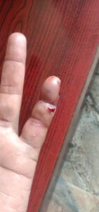 Up-sarpanch attacked Durg