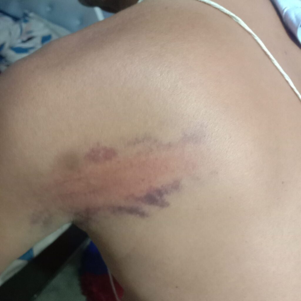 Up-sarpanch attacked Durg