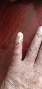Up-sarpanch attacked Durg